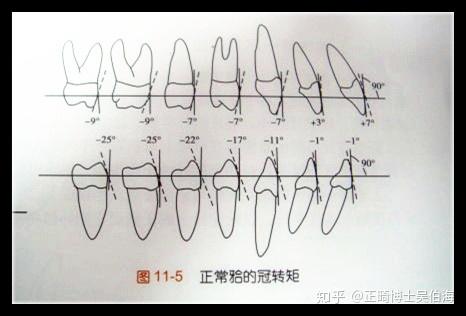上下切牙的关系和转距角   以上是正常的牙齿的排列角度和倾斜度
