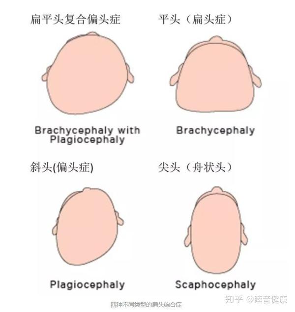 脑袋长得像颗栗子是一种什么样的体验