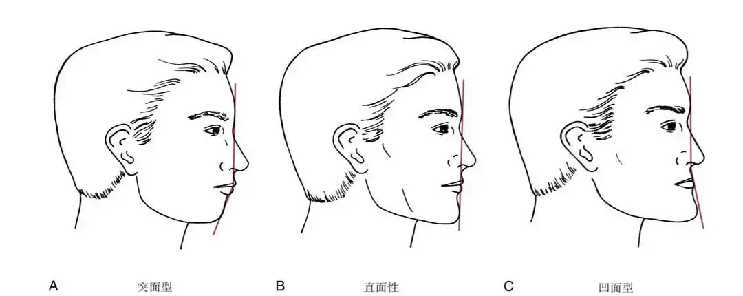 正畸可以通过改变牙的位置,嘴唇的突度和颏部的位置来让你变美.