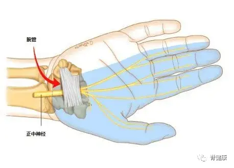 经常手麻小心这种病带来手部永久残疾