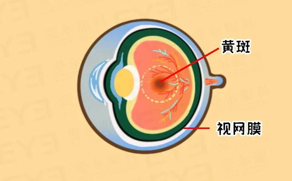 再拖,把眼底病当成白内障