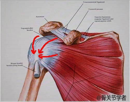 由四条韧带组成,包绕肱骨头,主要作用就是让你的肩关节更加稳定,肩膀