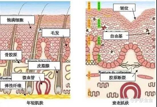 皮肤衰老的机理及表现特征