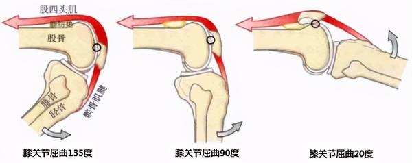 髌骨的前面粗糙,后面为关节面,上端与股四头肌相连,下端由髌韧带固定