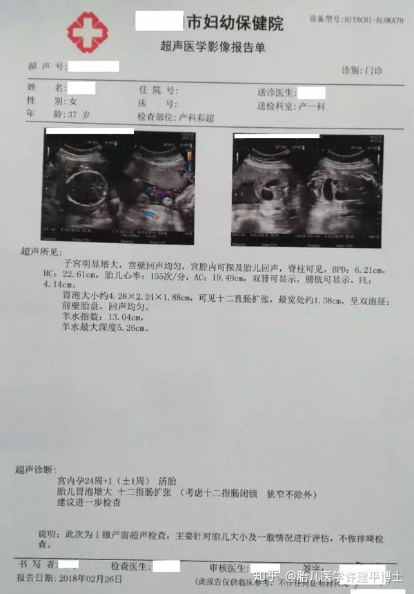 如果胎儿的十二指肠扩张,在胎儿超声显像胃部横切面上,会同时显示胃泡