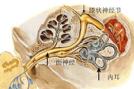 首大李健东:耳带状疱疹面瘫不仅要及时治疗 还要有足够的耐心