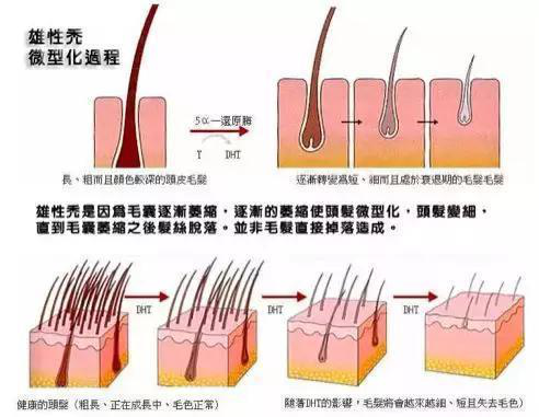 自测毛囊健康