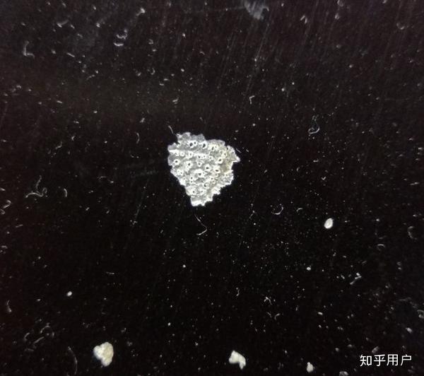为什么抠下来大块的头皮屑会有瞬间的快感?