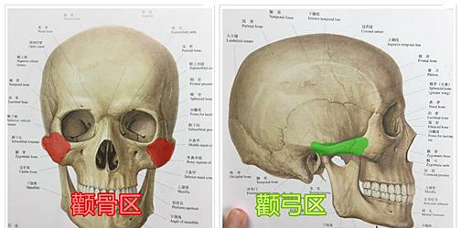 颧弓降低和颧骨内推的区别在哪里你get到了吗