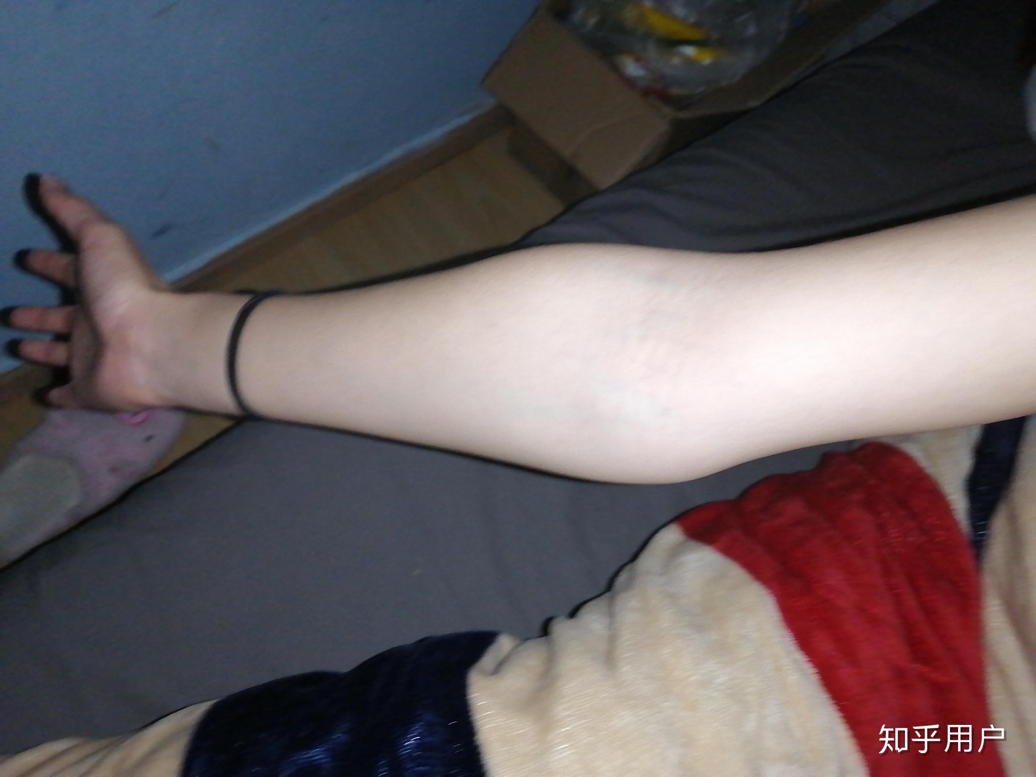 女生小臂粗是肌肉型的该怎么减啊