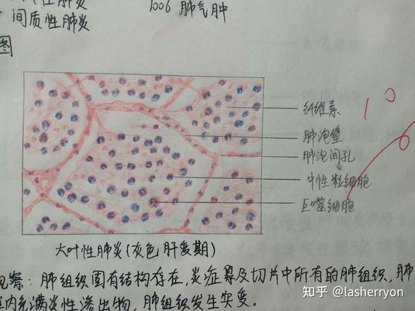 病理红蓝铅笔手绘图