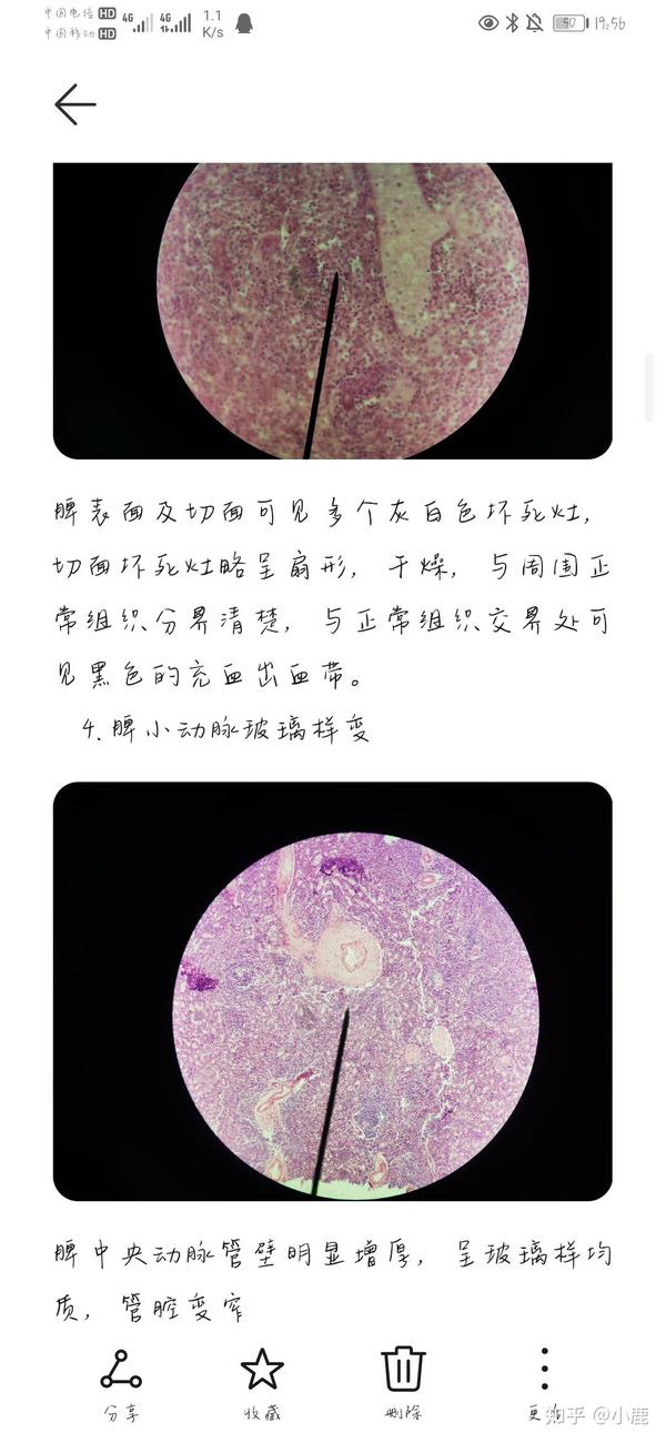 部分病理学切片红蓝铅笔手绘图,画的有一点点丑