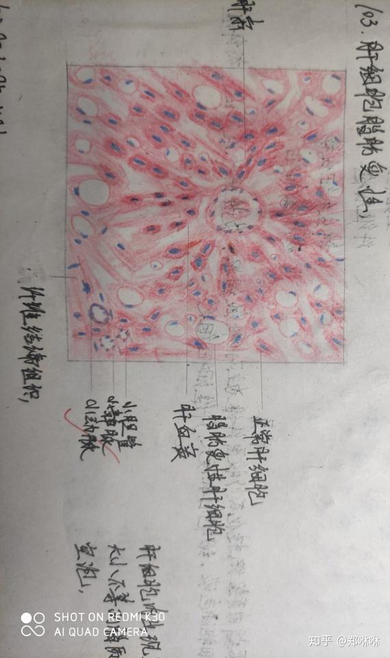 病理学红蓝铅笔图