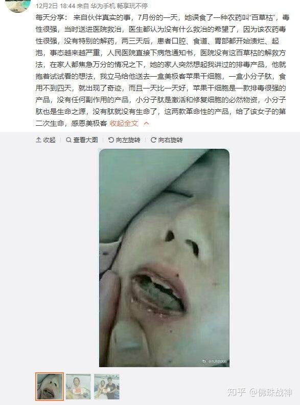 如何看待用来治疗百草枯的?中药复方?