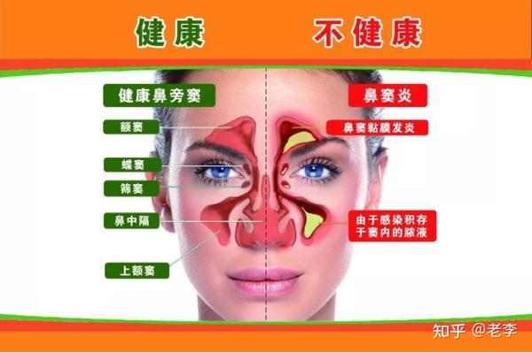 引起鼻塞的原因有什么只有鼻炎会吗