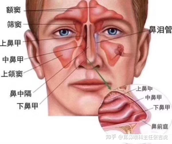 什么叫副鼻窦炎 zhuanlan.zhihu.com