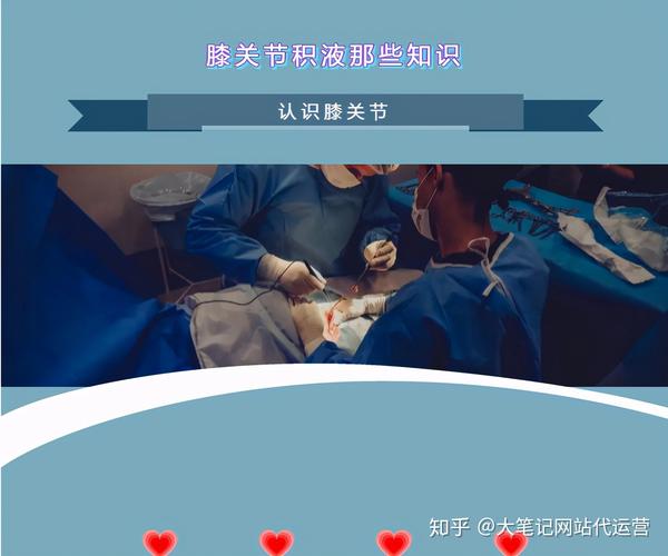 关于膝关节积液那点事