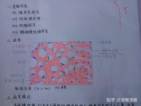 病理学红蓝铅笔绘图