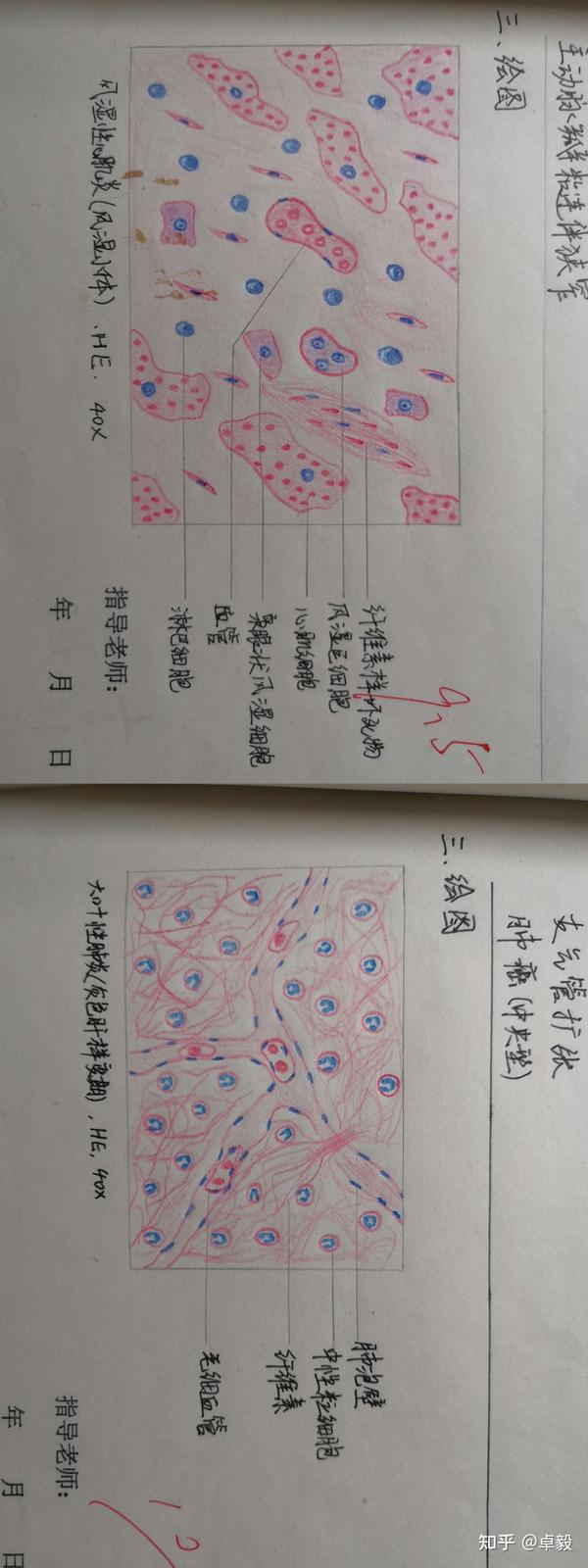 病理学红蓝铅笔绘图