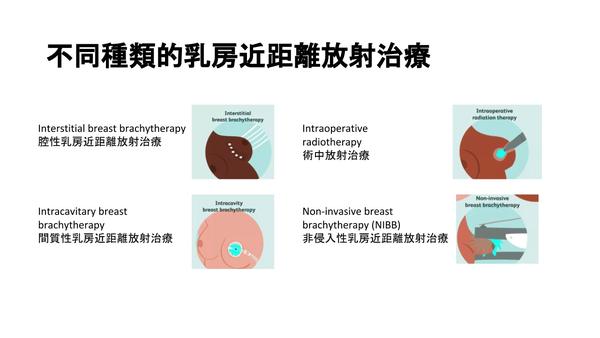 有不同种类的乳房近距离放射治疗