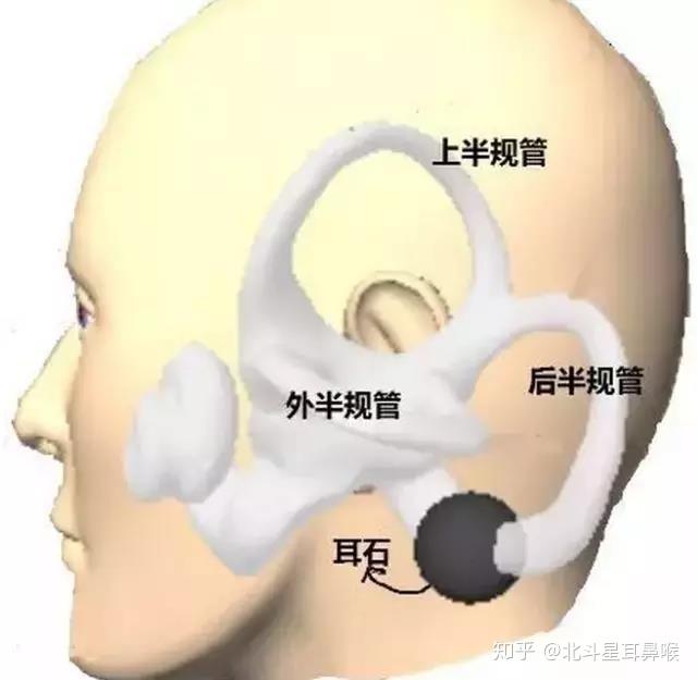 内耳里的一部分结构附有 耳石,当各种原因引起耳石脱落,在半规管内