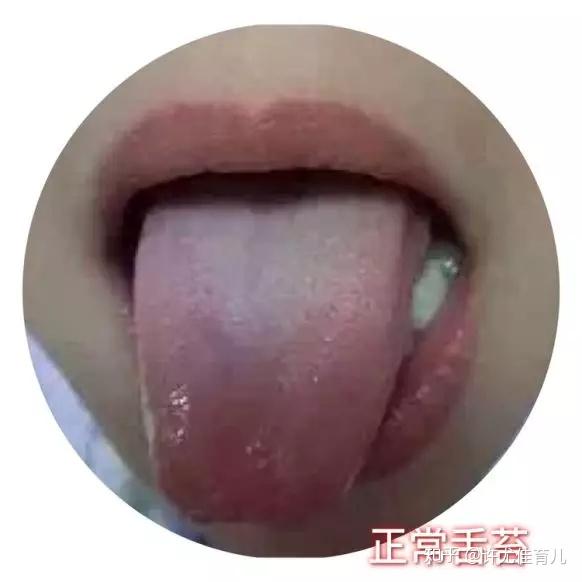 感冒时舌苔发白,是怎么回事?