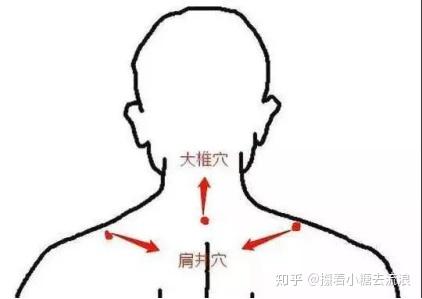 古法经络调理颈椎病