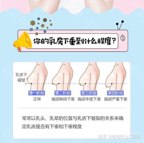 当宝宝断奶之后,乳房就会出现松垮,缩水等