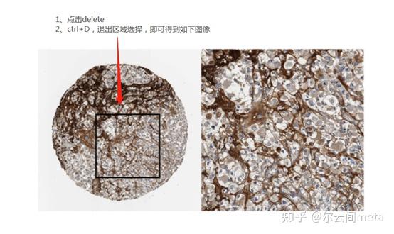 人类高质量科研图片生信sci免疫组化细节放大图绘制手把手教会你