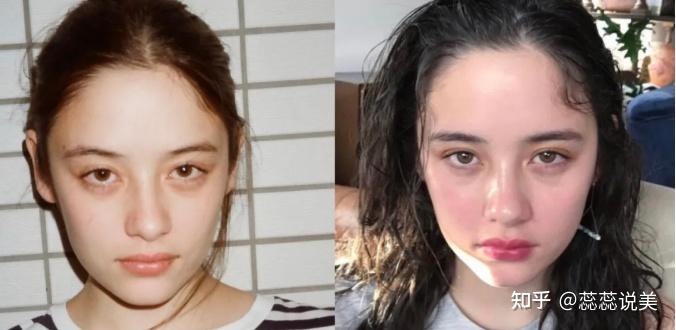 眼睛的位置取决于眼眶骨的位置,美人在骨不在皮,一旦牵扯到骨骼的