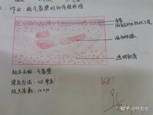 好多细节 9,肝小叶 12,次级卵泡高倍组织图 绘图ing,最后一张切片啦