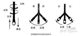 将探头顶端向食管远端或胃部移动称「推进」, 向相反方向拉出称之为