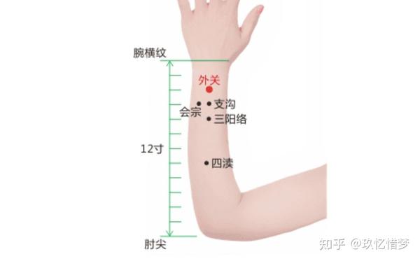 后溪:在手第5掌指关节尺侧近端赤白肉际凹陷中直刺0.5-1寸