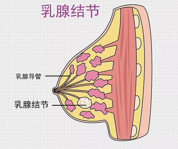 子宫肌瘤,甲状腺瘤,乳腺结节,一条藤结出的歪瓜,肝经一通全通