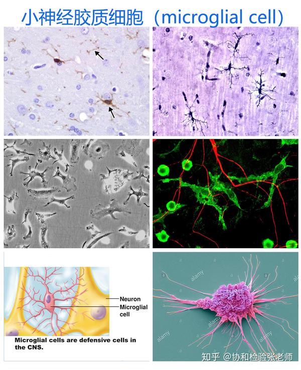 3 小神经胶质细胞:在神经系统,一般认为小神经胶质细胞起源于中胚层
