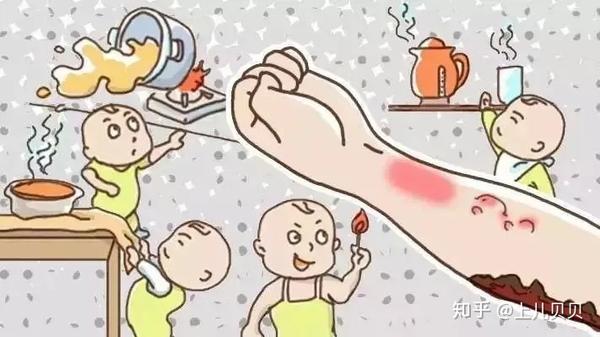 中度烫伤:这时的皮肤已经出现红肿水疱,还会溃烂破裂,也会有液体渗出