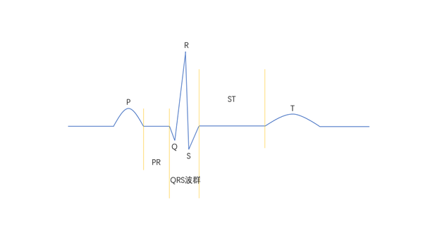 心电图