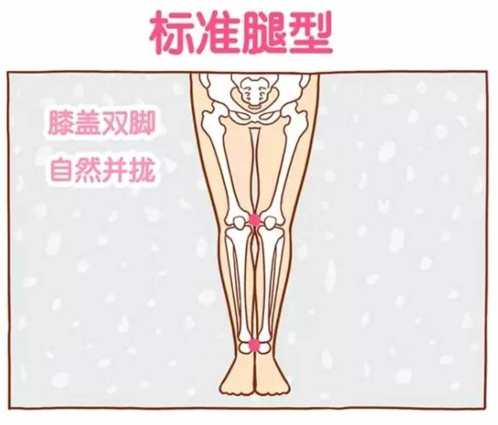 如果双下肢直立,并拢,则正面观察到,双大腿向中线靠拢,双膝关节内侧