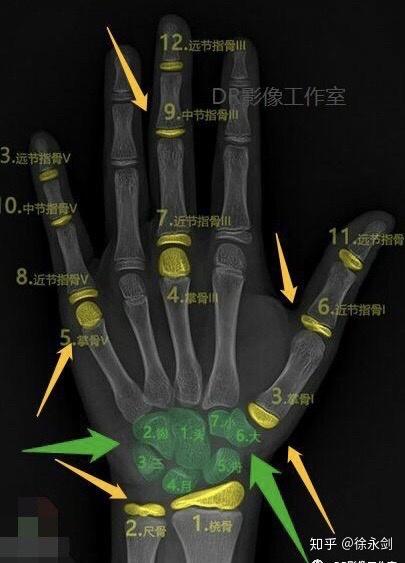 慎重看待chn法骨龄评价结果