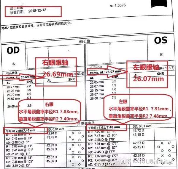 教你看懂眼科检查单之(三)眼轴和角膜曲率半径