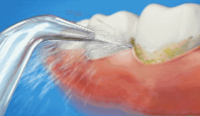 掌握正确刷牙方法