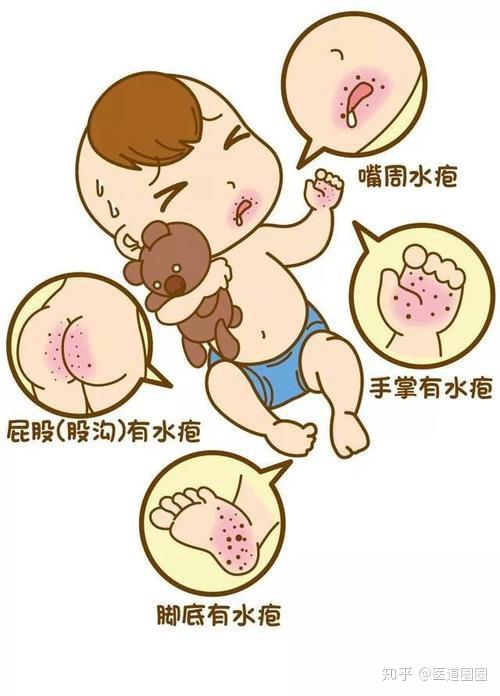 宝宝长疹子不要慌!常见的就是这几种了