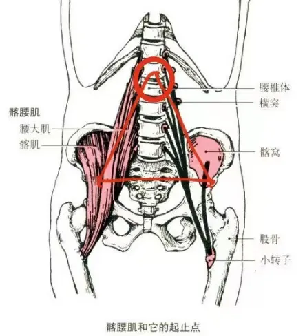 三角底下两侧,是两条纵向的 髂腰肌.