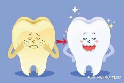 廊坊黄牙太丑了如何才能拥有一口白牙