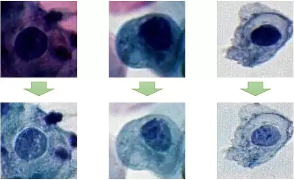 ideepwise干货丨基于深度学习的宫颈细胞液基涂片染色