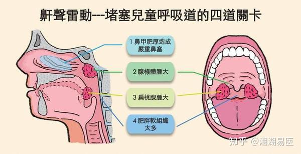 呼吸道就像是高速公路,从鼻子到肺,这一条呼吸的主要干道,时常塞车的