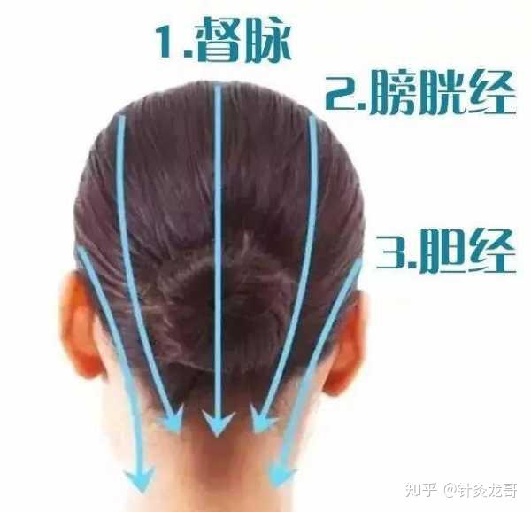 从头部经络的循行来区分头痛的类型,针灸取穴依据及特效引经草药