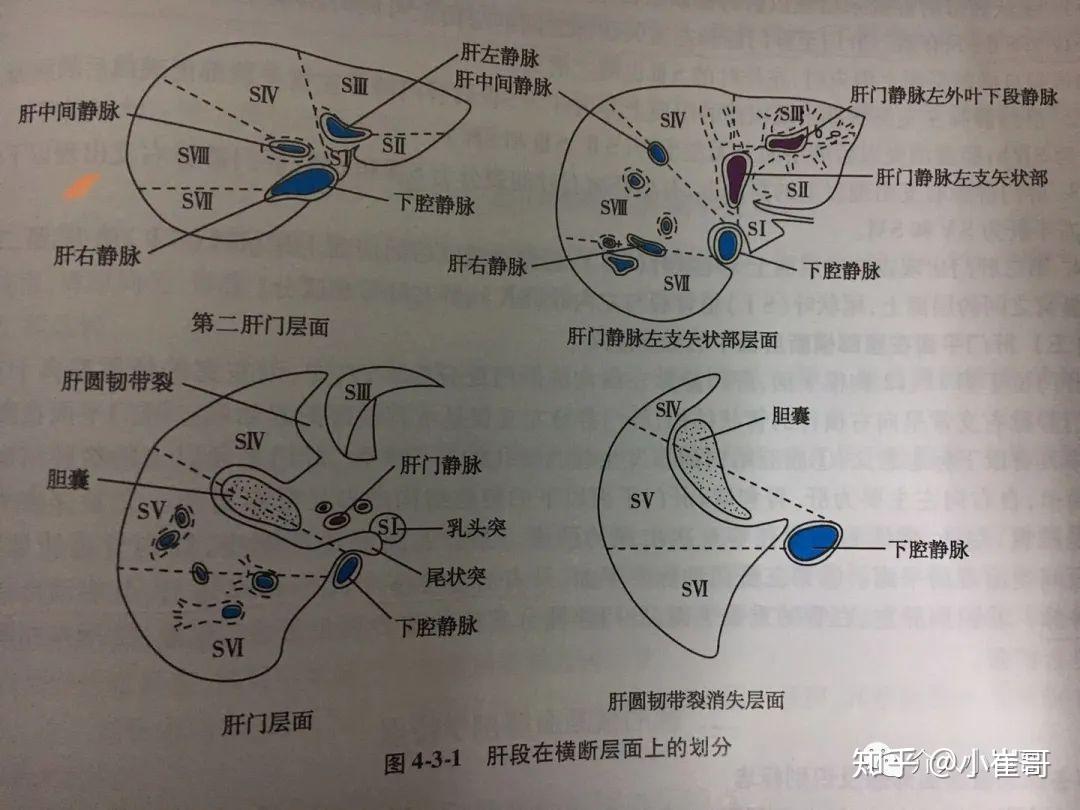 从上面的ct图,我们大致了解,s1和s4在肝脏的中间,s2和s3在肝脏的左边