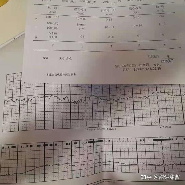 胎心监护不过关?别让胎儿缺氧了