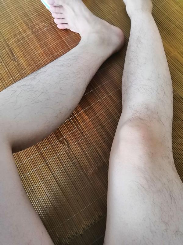 男生腿毛浓密怎么办?